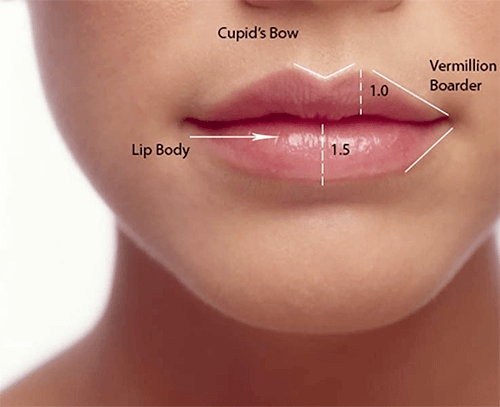 Lip Filler Explained